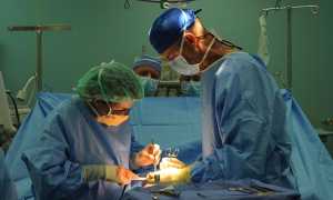 operazione