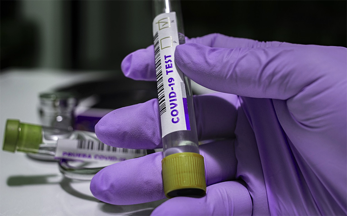 Distribuzione di test antigenici rapidi alle strutture residenziali regionali e Asl