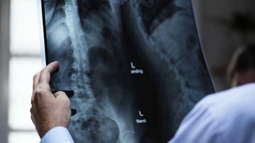 Asl No: accesso diretto per prestazioni di Radiologia ad Arona, Borgomanero e Oleggio