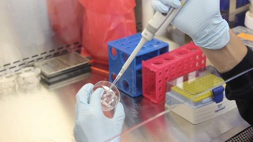 Test sierologici, Rossi: "Utili se inseriti in un piano epidemiologico regionale"