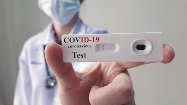 Test diagnostici antigenici rapidi per il personale dell'Università del Piemonte Orientale