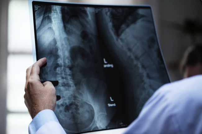 Giornata Mondiale dell'Osteoporosi:  anche all'Aou di Novara il 20 ottobre Open Day sulla salute delle ossa