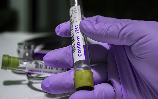 Sequenziamento delle acque reflue: Omicron BA.5 dominante. Presenti molte sottovarianti