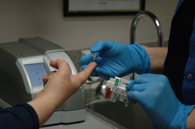 Test sierologico, dove farlo: ecco i laboratori autorizzati dalla Regione