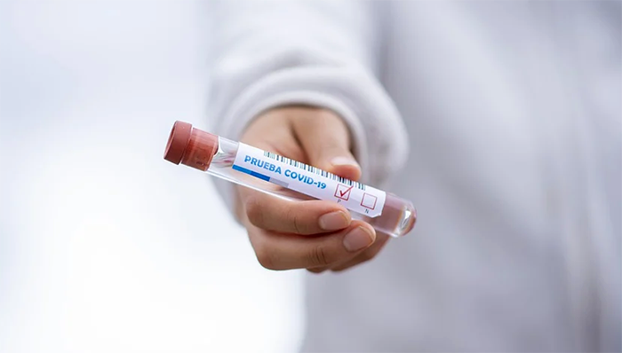Piemonte: via ai test Covid-19 a medici di famiglia, pediatri e personale sanitario
