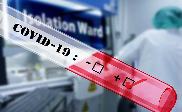 Coronavirus, salgono a 21 i deceduti in Piemonte, 501 i positivi