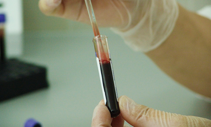 Coronavirus, secondo morto in Piemonte. Salgono a 108 i positivi al primo test in Regione