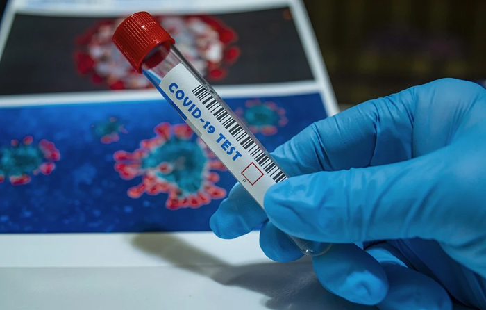 Covid, dalla Regione 10 milioni di euro per potenziare i laboratori pubblici e sviluppare progetti di ricerca