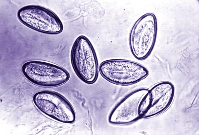Epidemia di vermi intestinali alle scuole di Intra. I genitoi chiedono la disinfestazione 