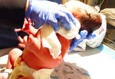 Si stacca la placenta mentre fa un esame al San Biagio. Parto d'urgenza, è nata una bimba, Iris