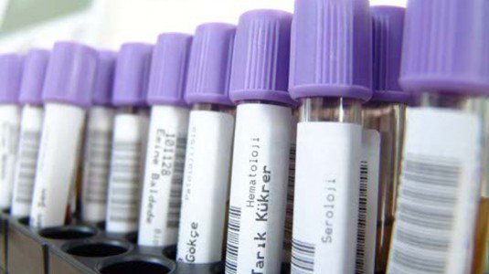 Manca il personale, al “Castelli” salta la terapia anticoagulante